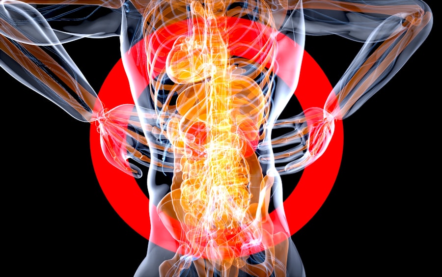 Abdominal CT scan