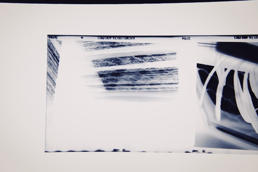 MRI scan