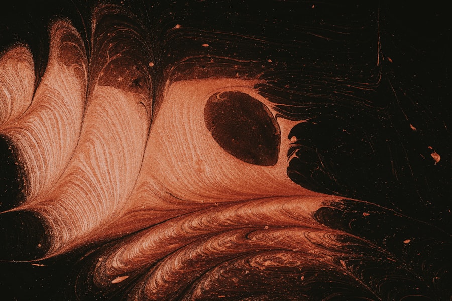 Bladder scan