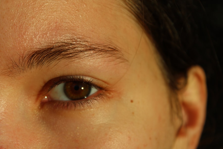 Skin irritation
