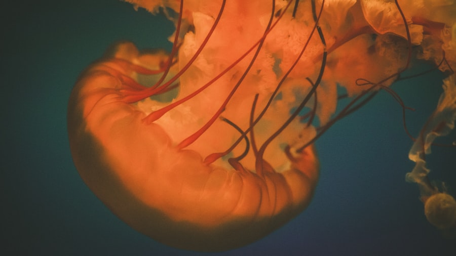 Gallbladder ultrasound