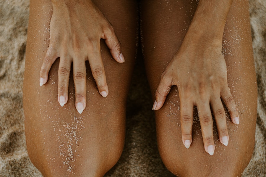 Skin rash