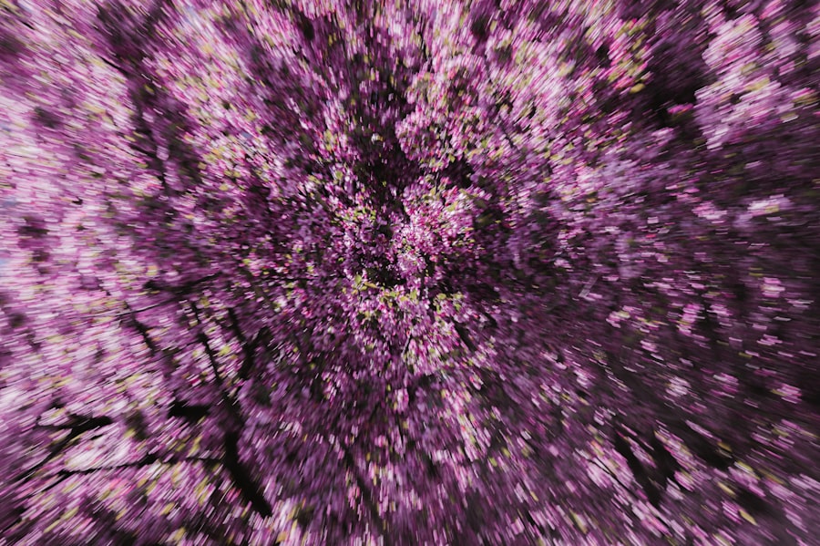 MRI scan