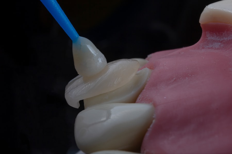 Nasal endoscopy