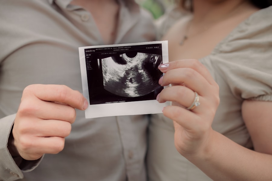 Ultrasound scan