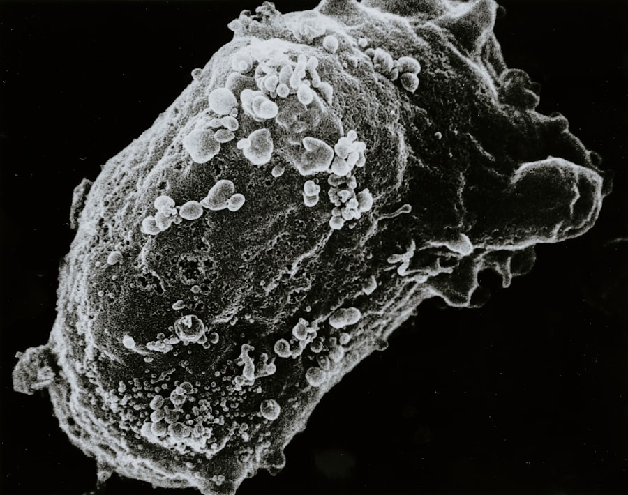 Abnormal cells
