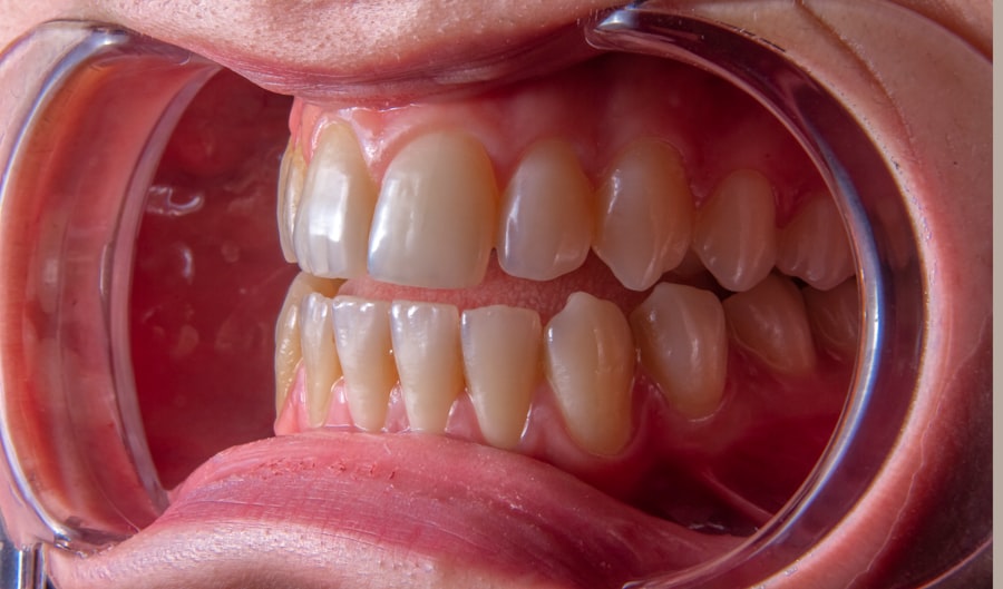 Dental plan