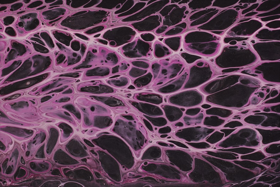 Bone marrow biopsy