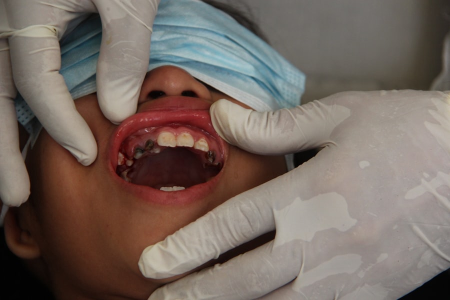 Dental coverage