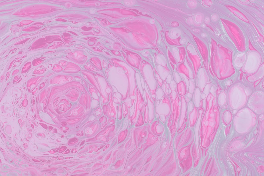 Mammogram result
