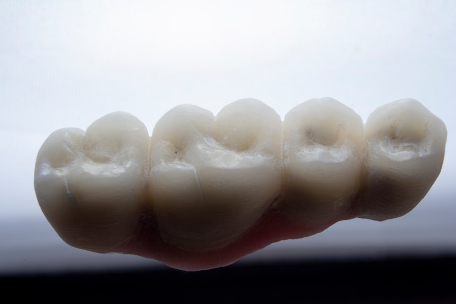 Dental X-ray