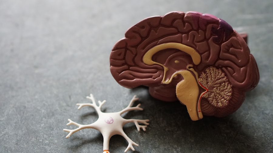 Brain scan