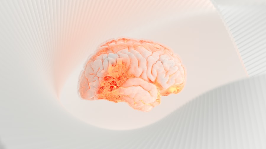 Brain MRI