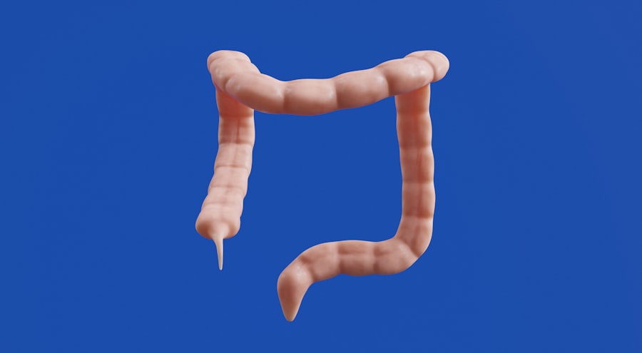 Medical illustration