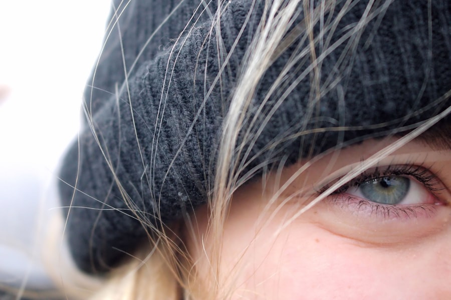Cold cap
Hair loss