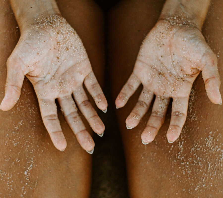 Skin rash