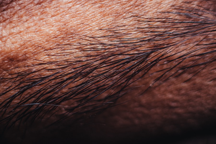 Skin lesions