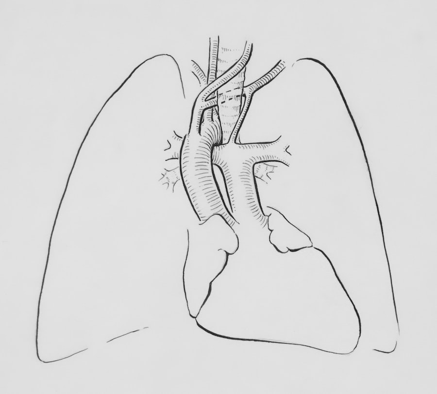 Heart diagram