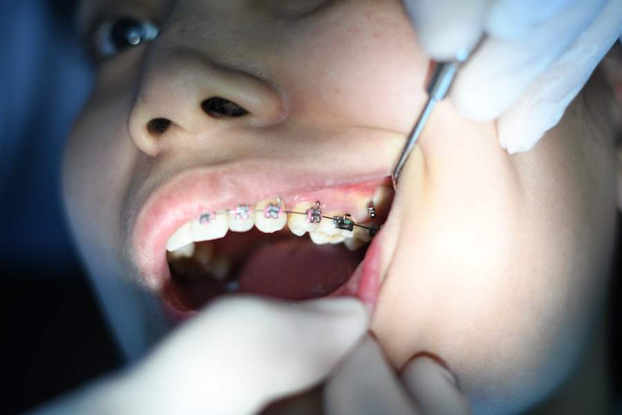 Dental insurance