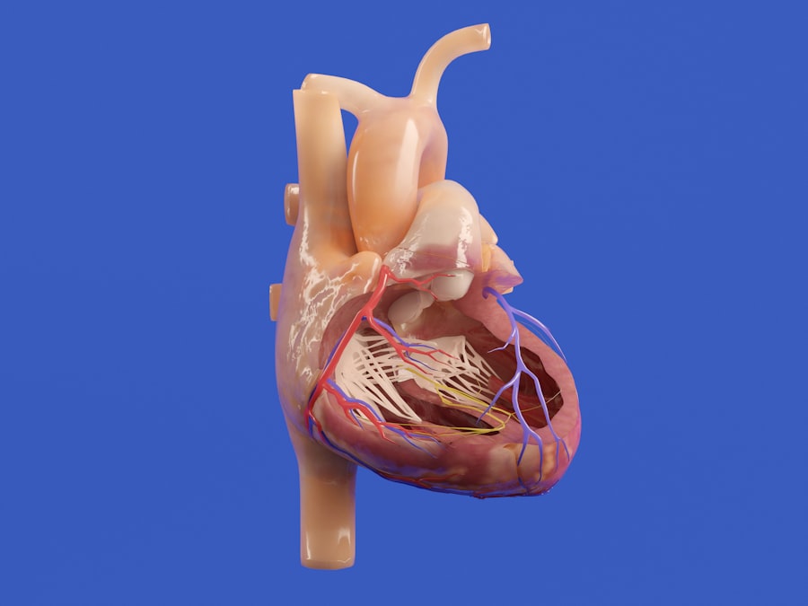 Blocked artery