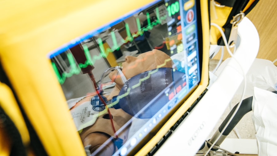 ECG monitor