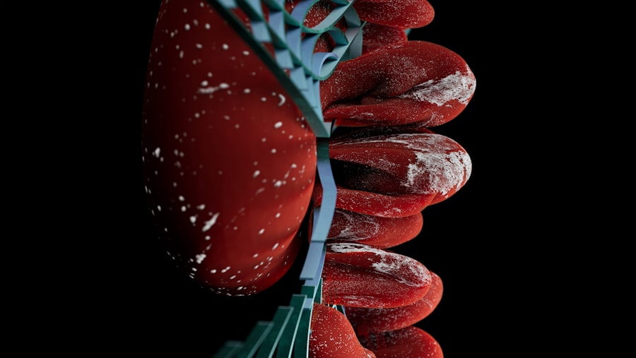 Blocked artery