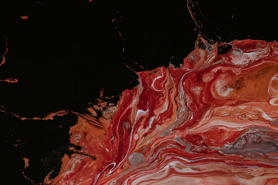 Blocked artery