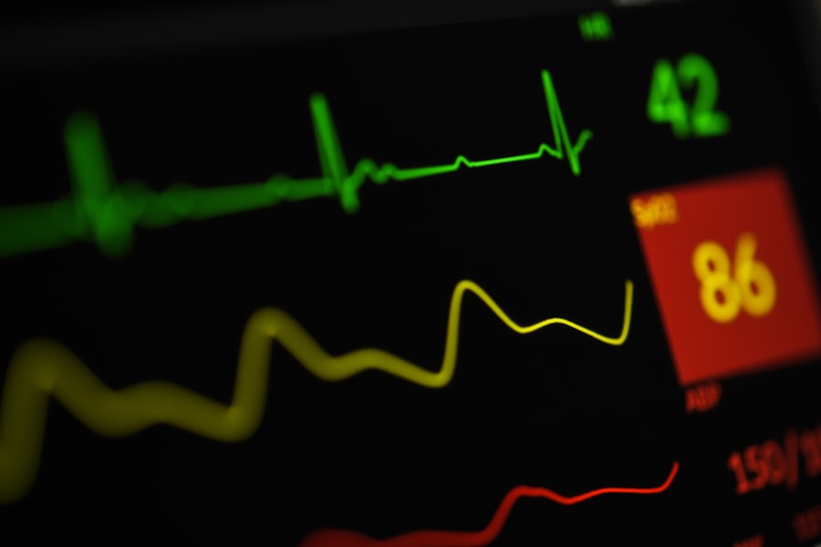 heart monitor