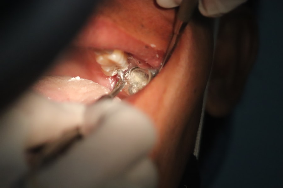 Dental coverage