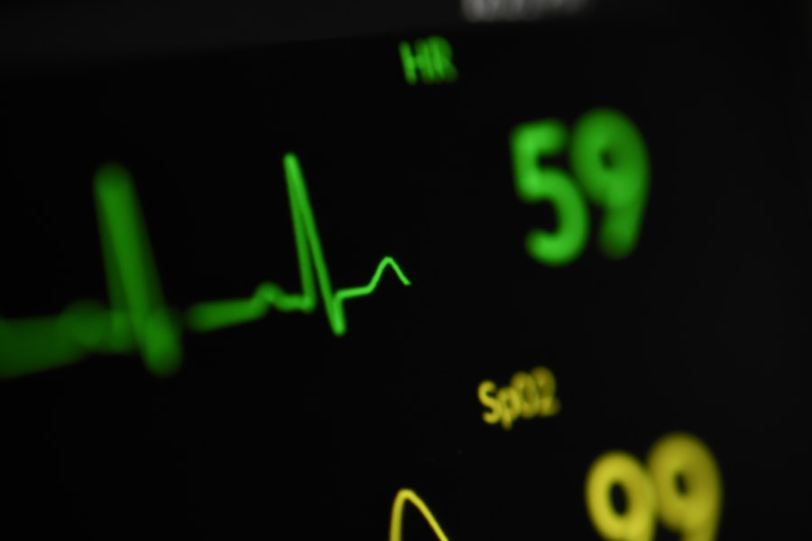 Heart monitor