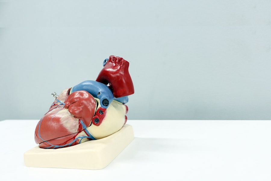 ECG monitor
