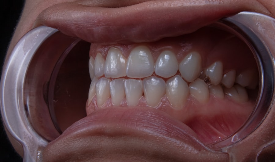 Dental network