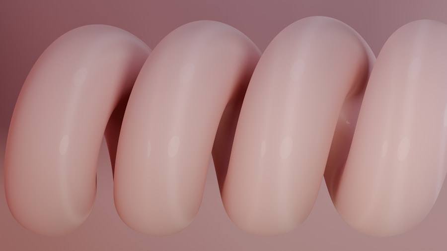 Stent placement