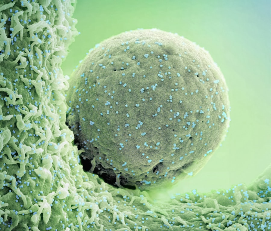 Cancer cells