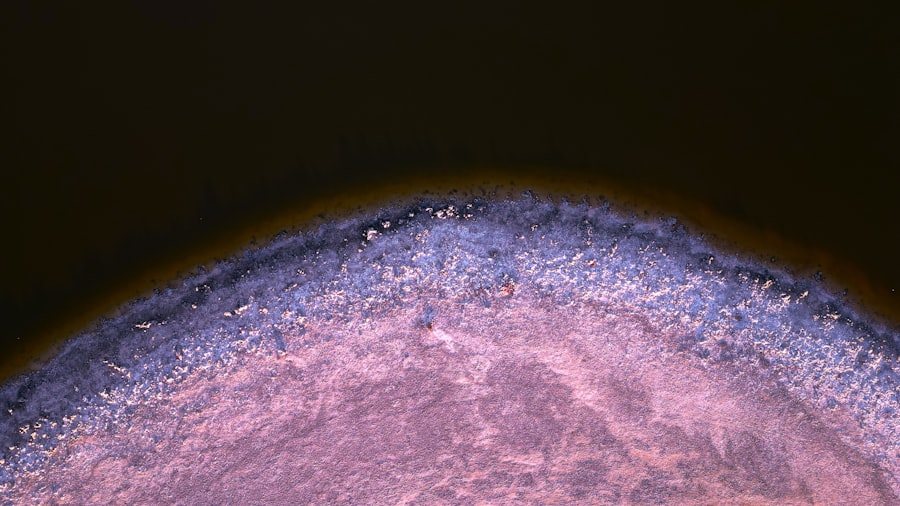 Photo Bone marrow biopsies
