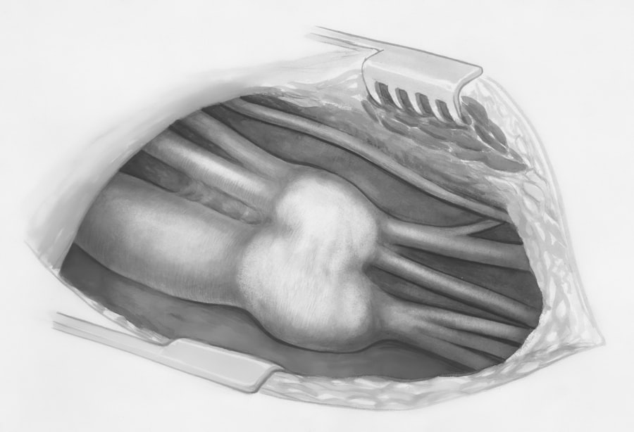 Photo X-ray scan