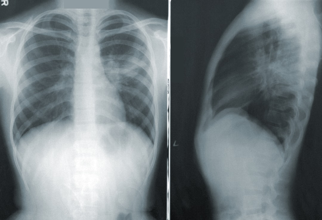 Photo X-ray image