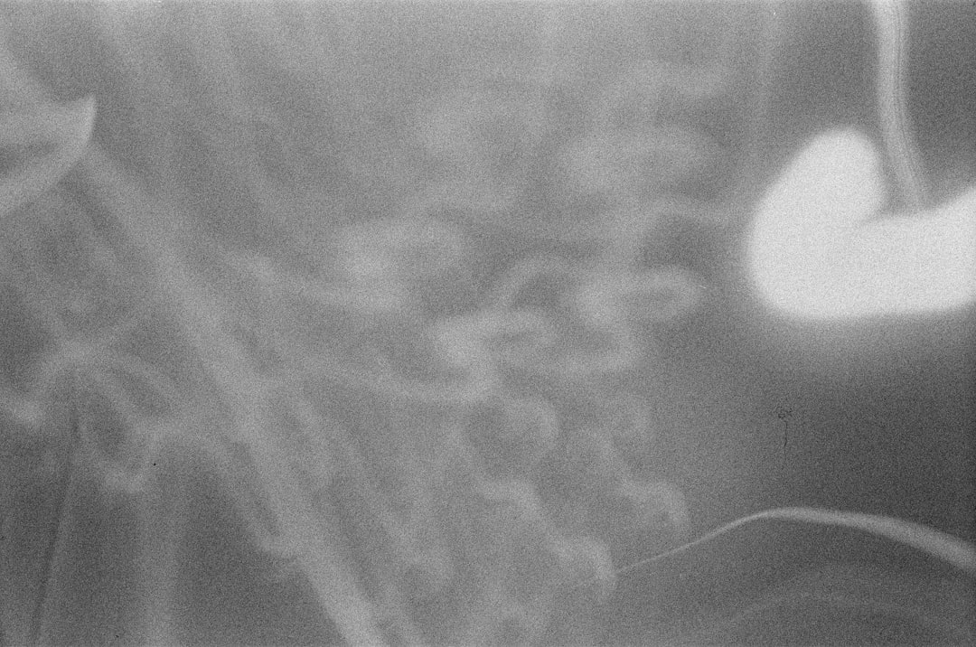 Photo X-ray scan