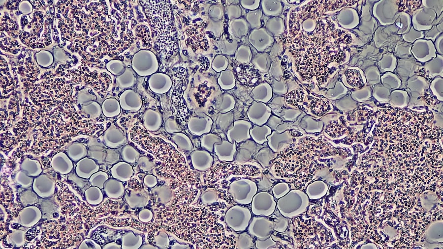 Photo Skin cells
