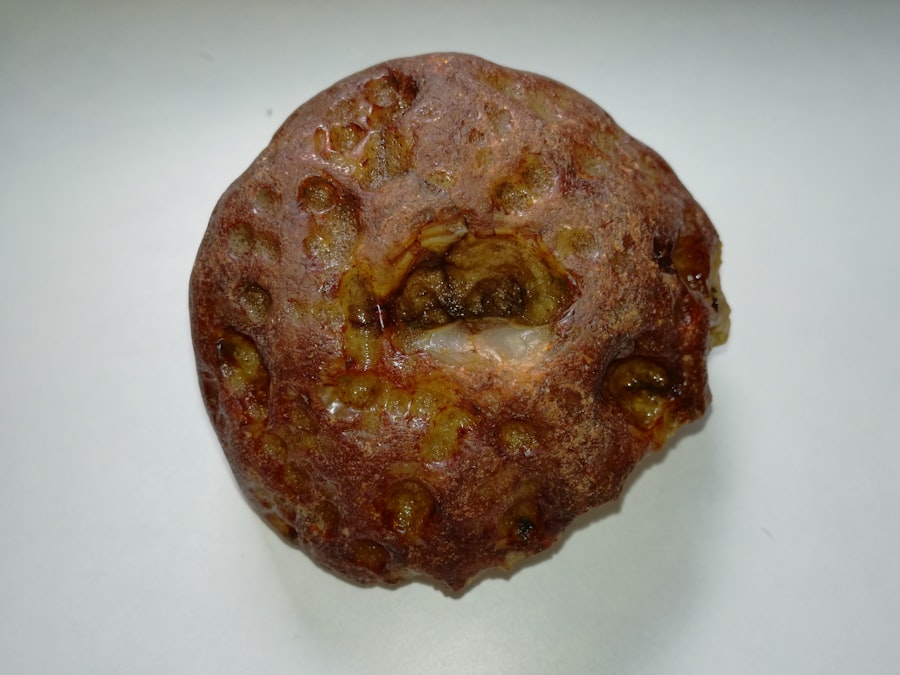 Photo Testicular tumor