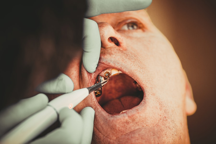 Photo Dental insurance