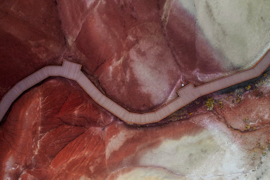 Photo Gallbladder ultrasound