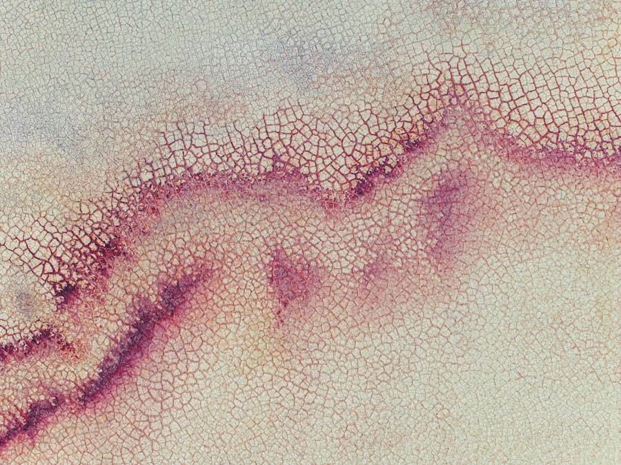 Photo Cervical smear