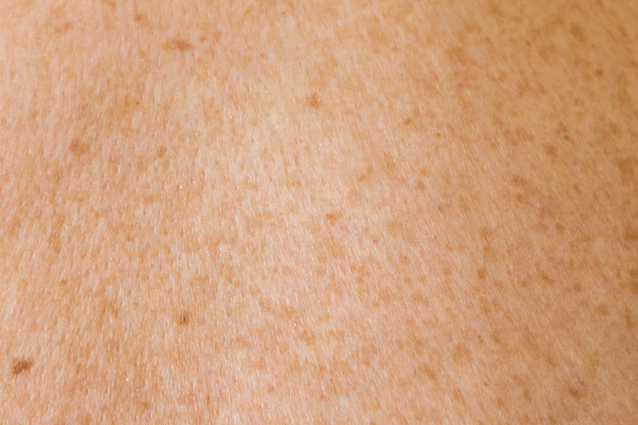 Photo Skin rash