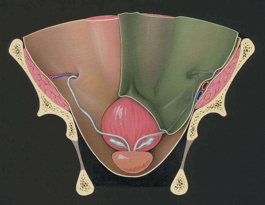 Photo Colonoscopy results