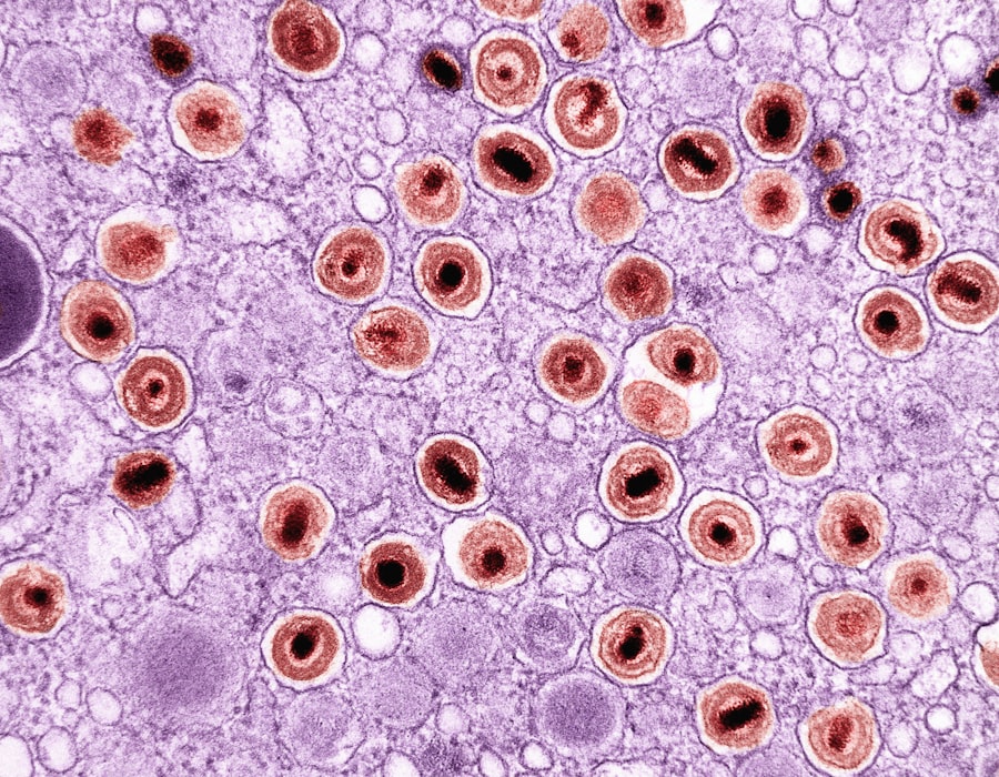 Photo Abnormal cells