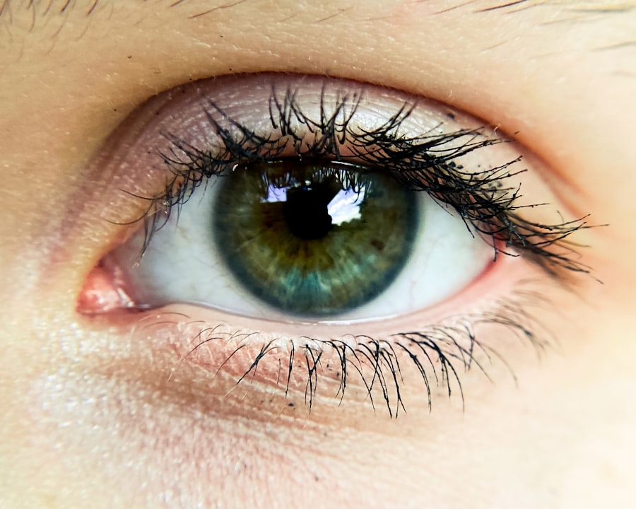 Photo Eye examination