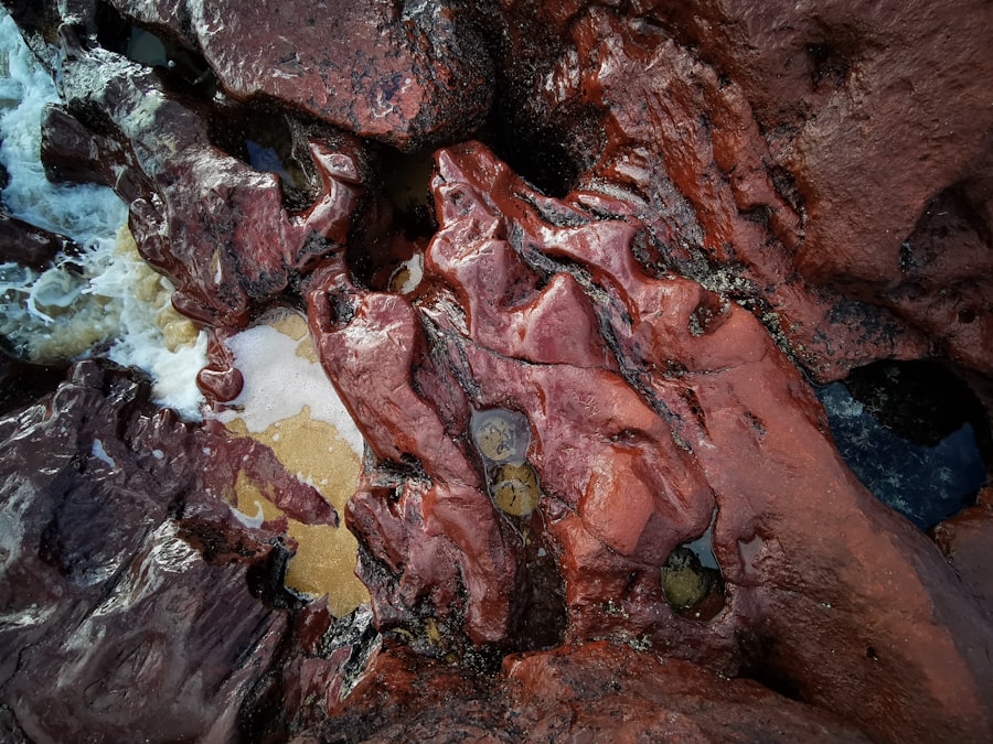 Photo Liver damage