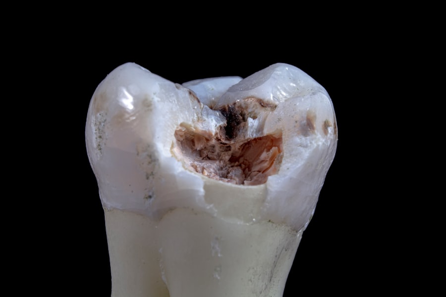 Photo Dental X-ray