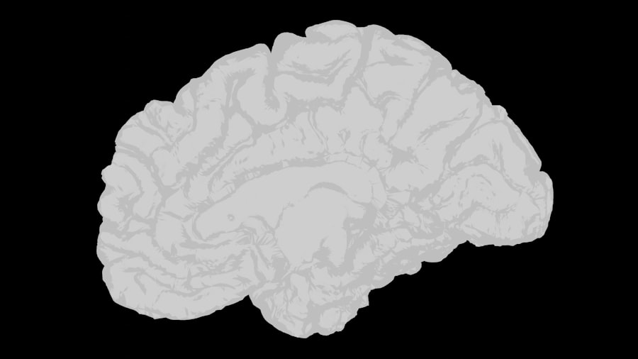 Photo Brain MRI
